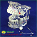 DENTAL08 (12567) Transparente Zahnimplantat-Krankheits-Zahn-Modelle Wiederherstellung